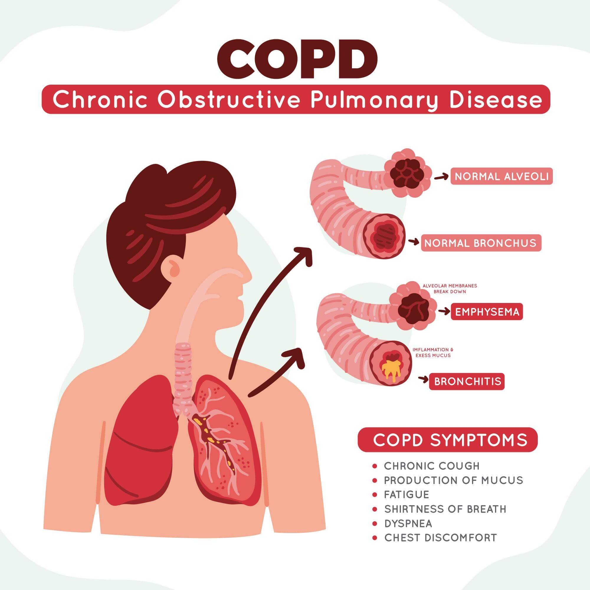 What are symptoms for COPD