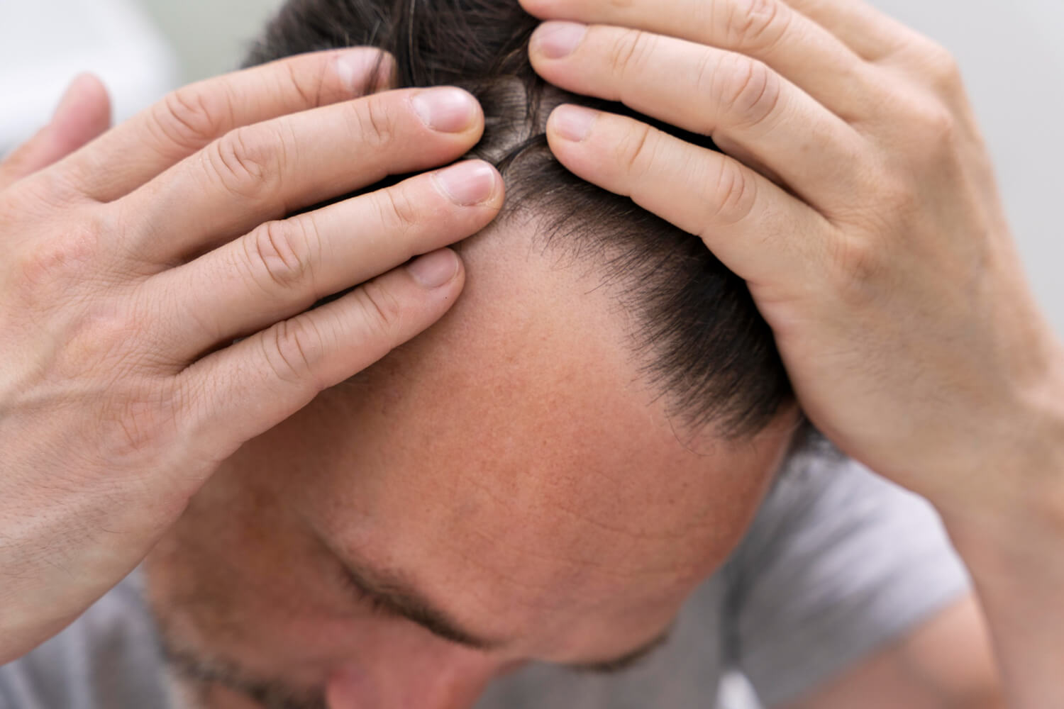 How to Stop Hair Fall Immediately at Home in Male